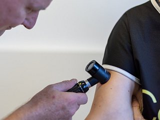 Durchführung eines Hautkrebs-Screenings