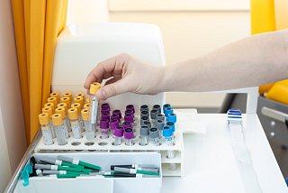 Etikettierte Proben im Labor