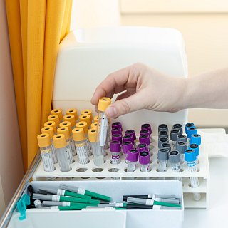 Etikettierte Proben im Labor